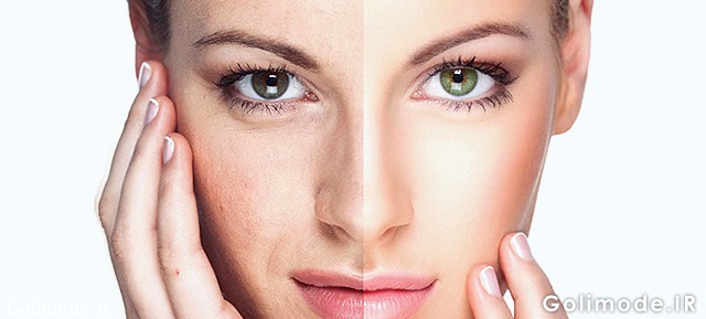 پلاکت درمانی یا پی آر پی چیست